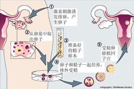 遗传阻断案例